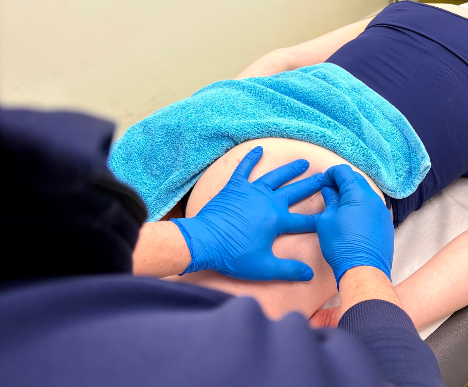 Fysiotherapeut localiseert triggerpoints in de heup voor dry needling behandeling